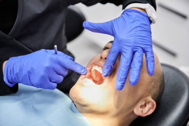 Best Emergency Tooth Extraction in Agua Dulce, TX